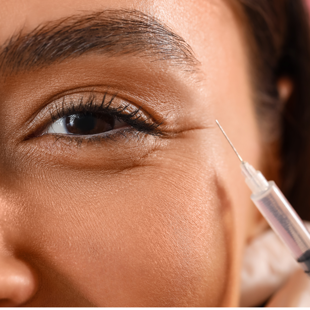 Dermal Filler eye