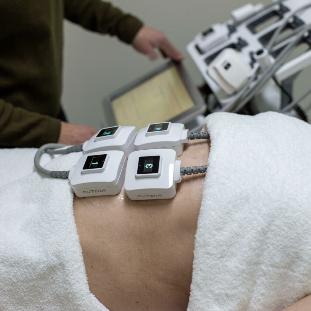 Belly TruSculpt Treatment in Progress in Tasmania Belly TruSculpt Treatment in Progress in Tasmania