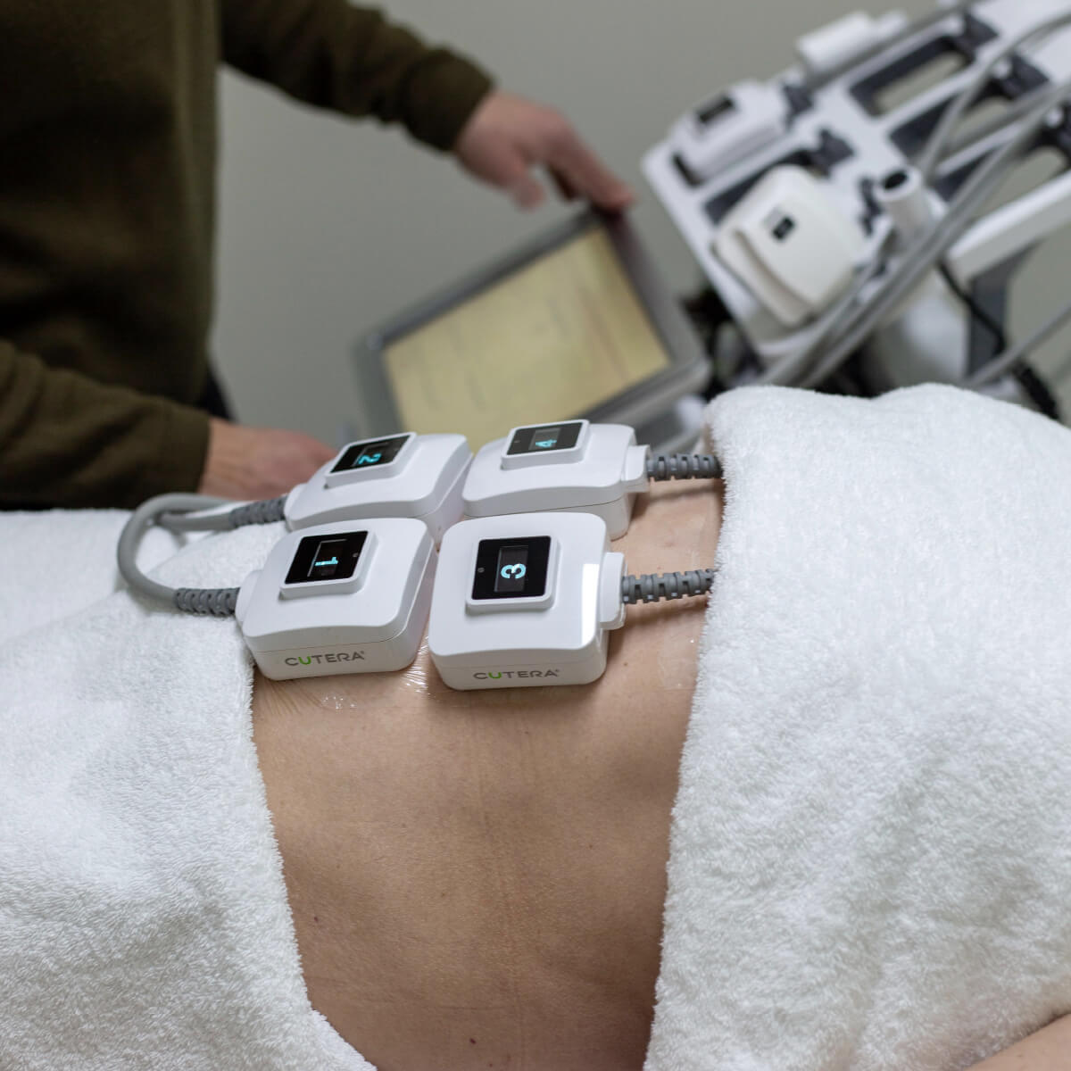 Belly TruSculpt Treatment in Progress in Tasmania