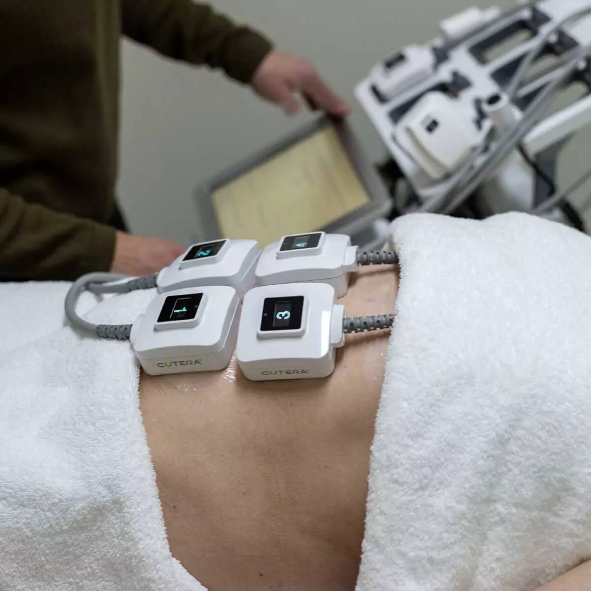 Belly TruSculpt Treatment in Progress in Tasmania