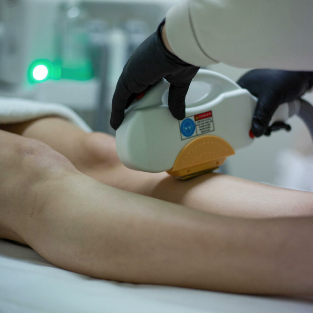 Close Up Front Legs SuperLUX SHR SHR/IPL Hair Removal