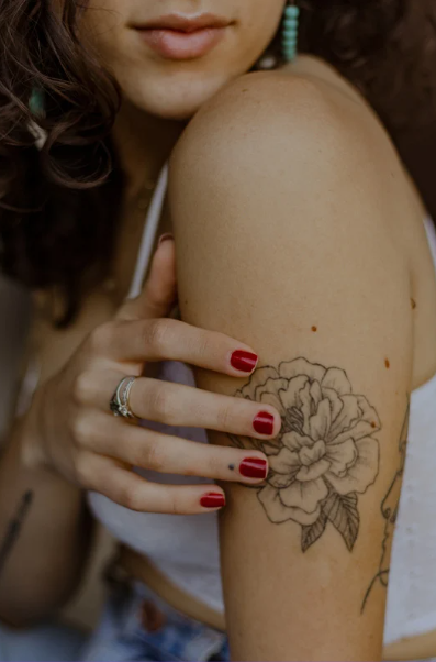 Laser Tattoo Removal