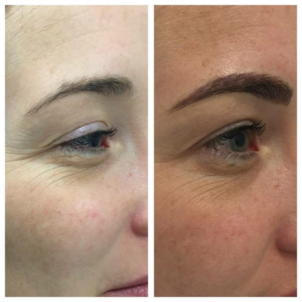 brow tattoing before and after Cosmetic Tattooing