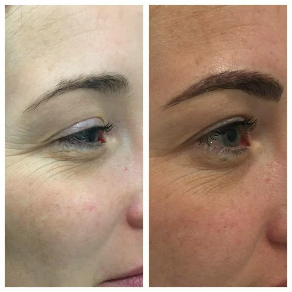 brow tattoing before and after Cosmetic Tattooing