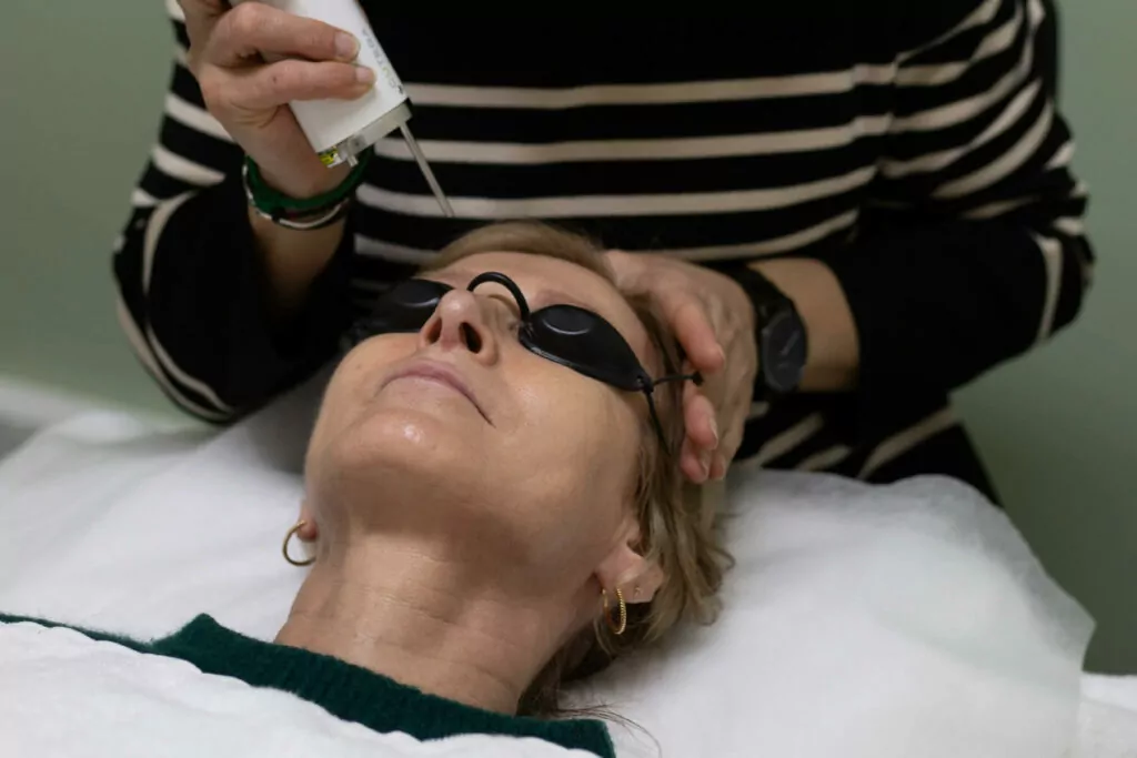 Pico Genesis Laser Tanya Pico Genesis Laser