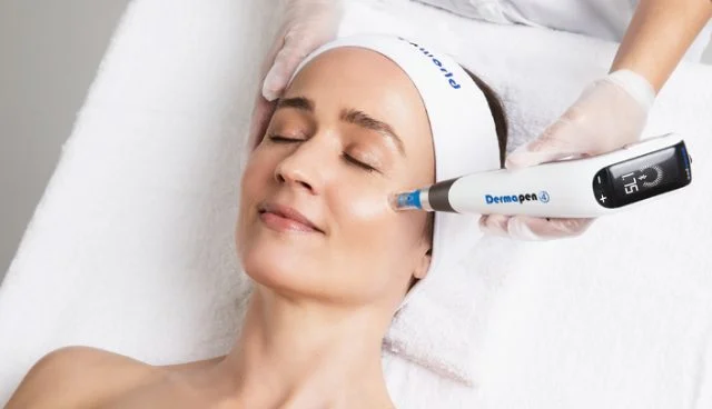 Dermapen Skin Needling