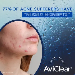 77% of acne sufferers have missed moments.