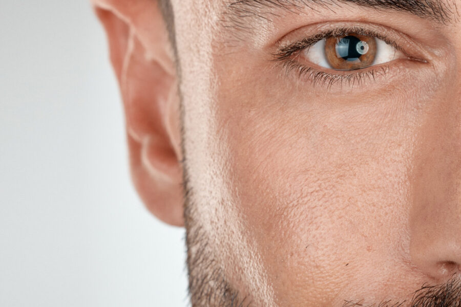Close-up face with no visible acne, showcasing skin concerns in need of treatment.