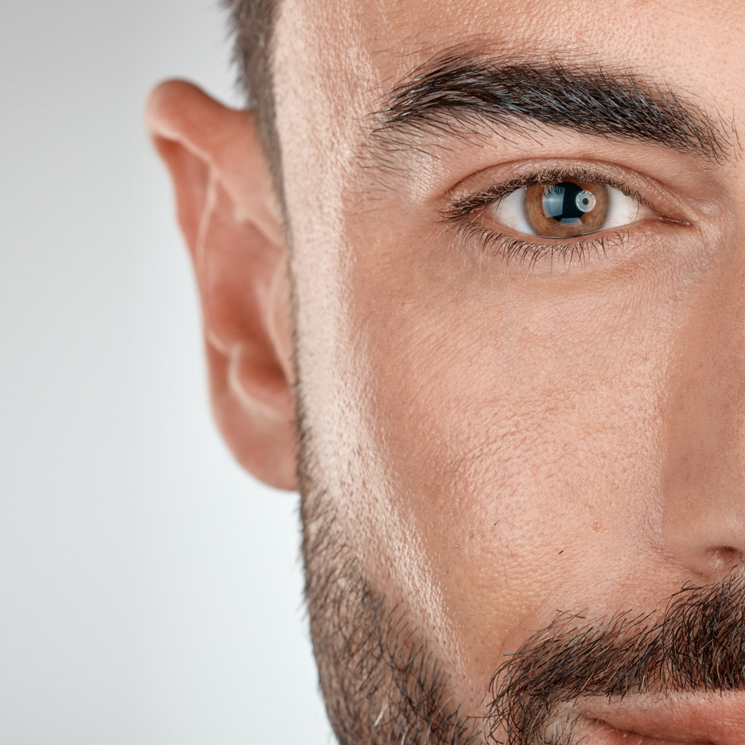 Close-up face with no visible acne, showcasing skin concerns in need of treatment.