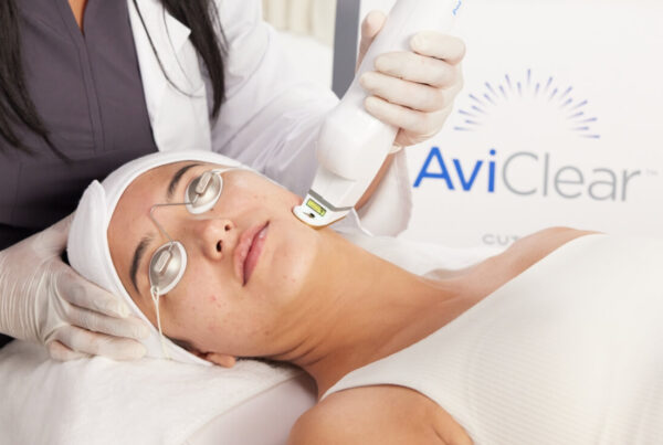 "AviClear machine used for acne treatments at Sharkra Medi Spa in Hobart"