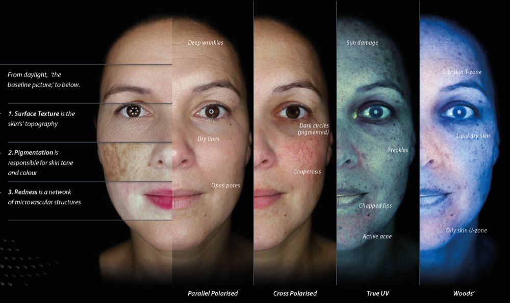 OBSERV2